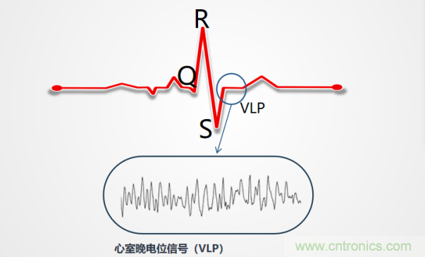 解決心電監(jiān)測行業(yè)難題，曼森伯格的濾波技術(shù)獲國家知識產(chǎn)權(quán)局發(fā)明授權(quán)